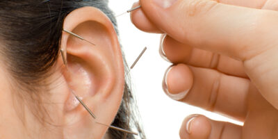 acupuncture therapy on auricle, horizontal very close up photo